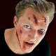Woochie Injury 3D FX Kit