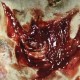 Zombie Torn Throat FX Transfer